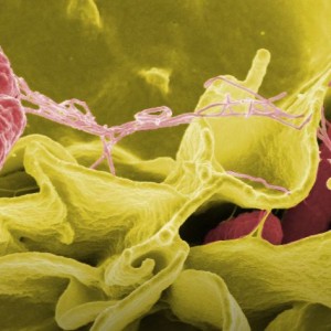 Ứng dụng nano bạc chống lại mầm bệnh trong thực phẩm